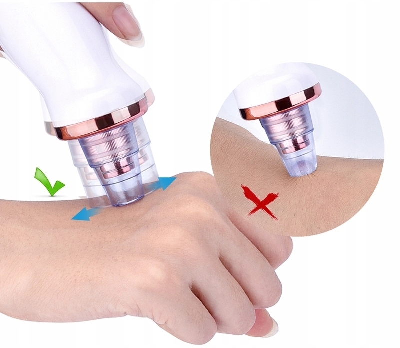 ODKURZACZ WĄGRÓW ZASKÓRNIKÓW MIKRODERMABRAZJA Marka SkinClear