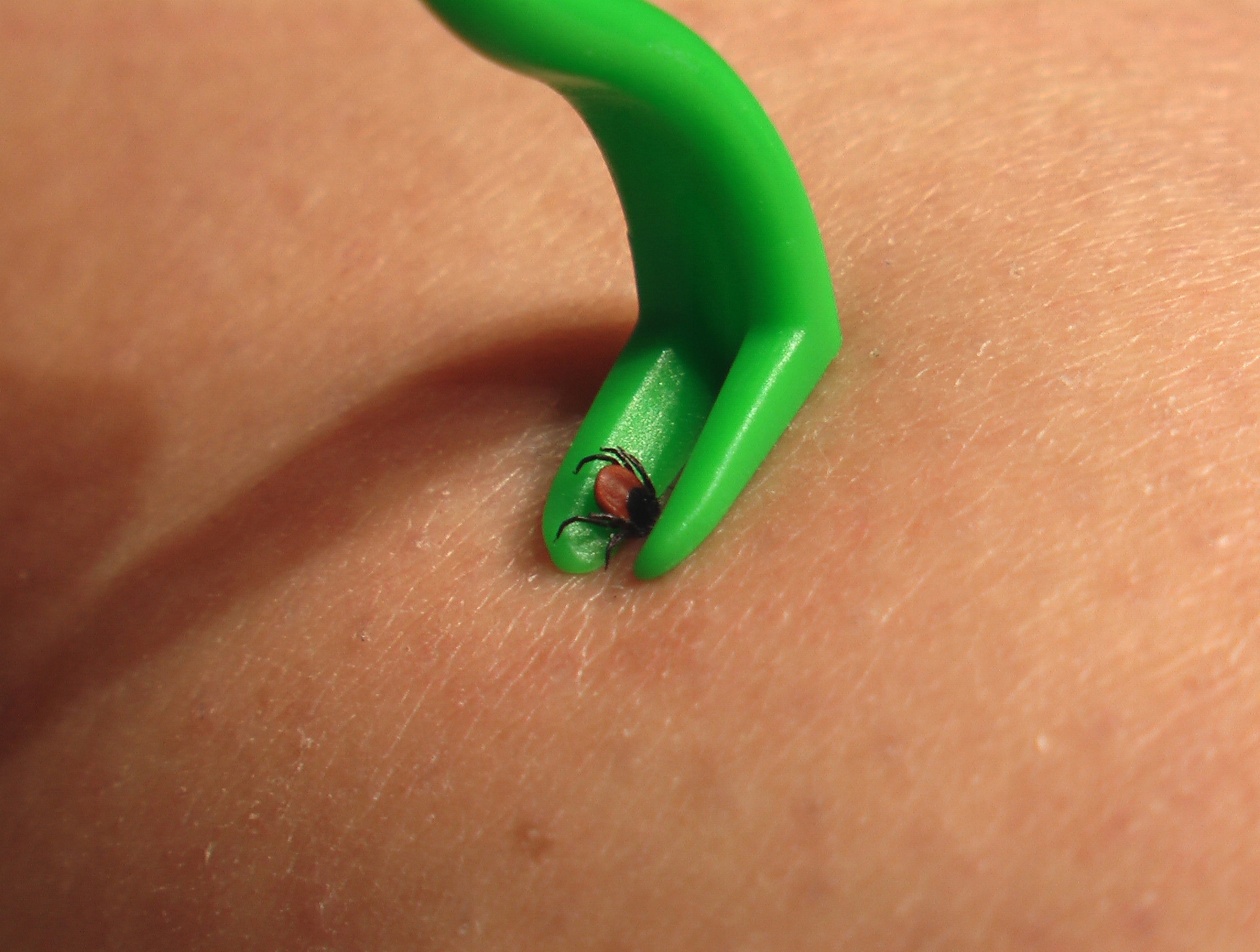 Zestaw dwóch haczyków – Duży i mały do różnych rozmiarów kleszczy