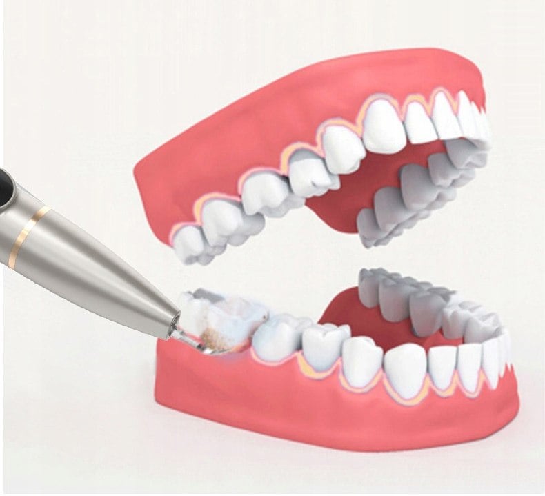 Skaler Dentystyczny Kamera Ultradźwiękowy Braders Rodzaj brak informacji
