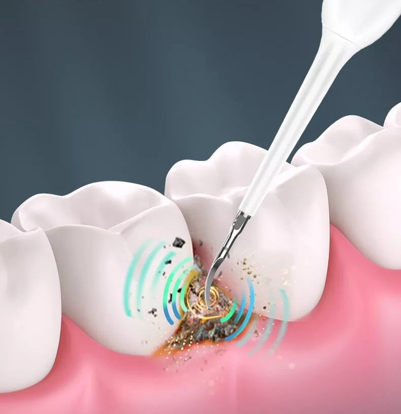 SZCZOTECZKA SONICZNA SKALER USUWA KAMIEŃ HELBERG EAN (GTIN) 5903772142822