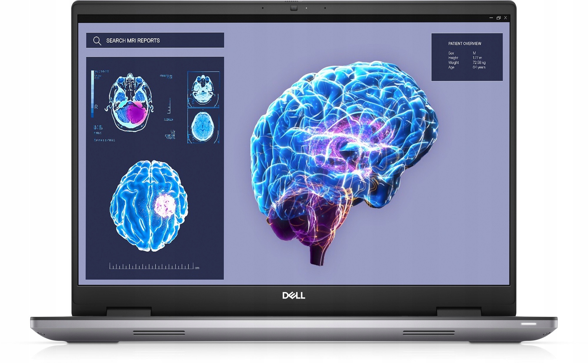 Laptop Dell Precision 7680 – Wydajność i mobilność dla profesjonalistów