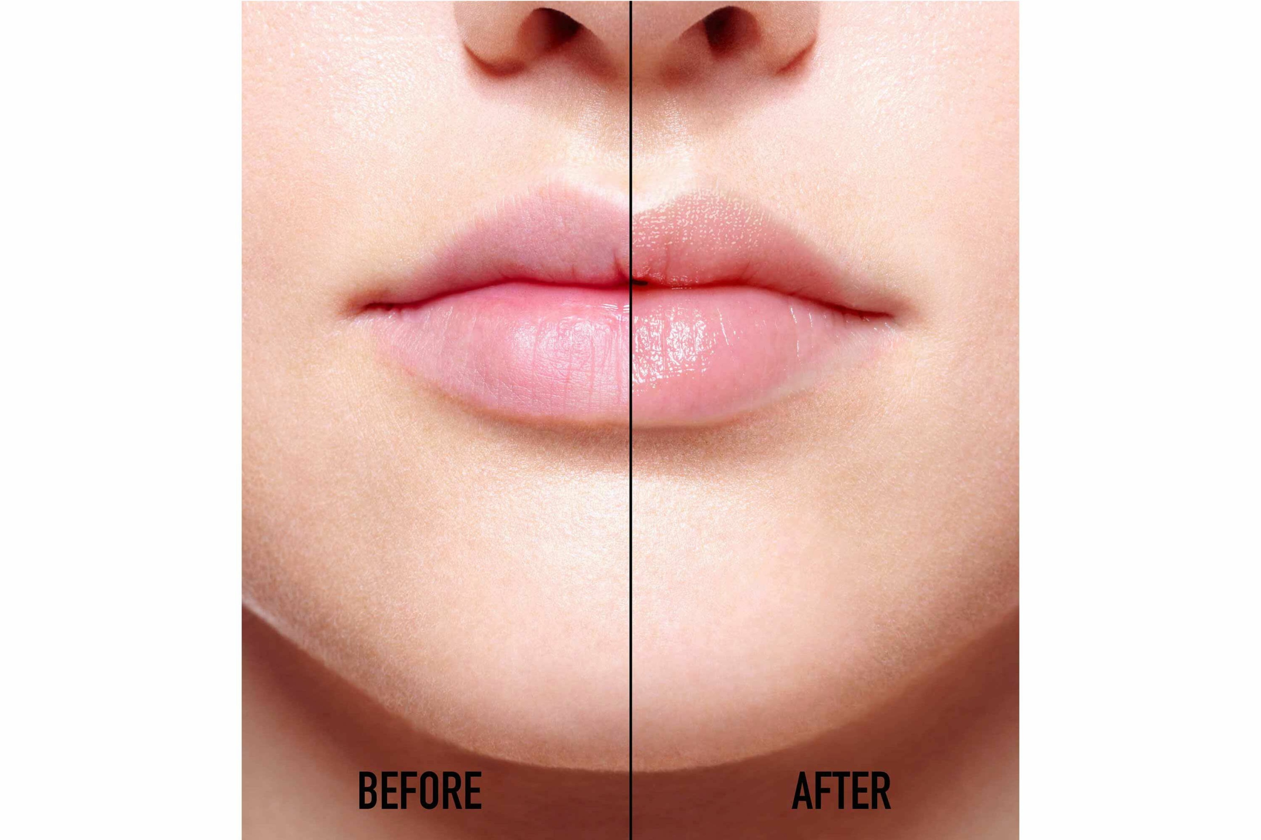 Efekt pełnych i błyszczących ust