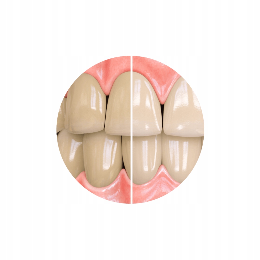 Efektywne wybielanie i ochrona przed próchnicą