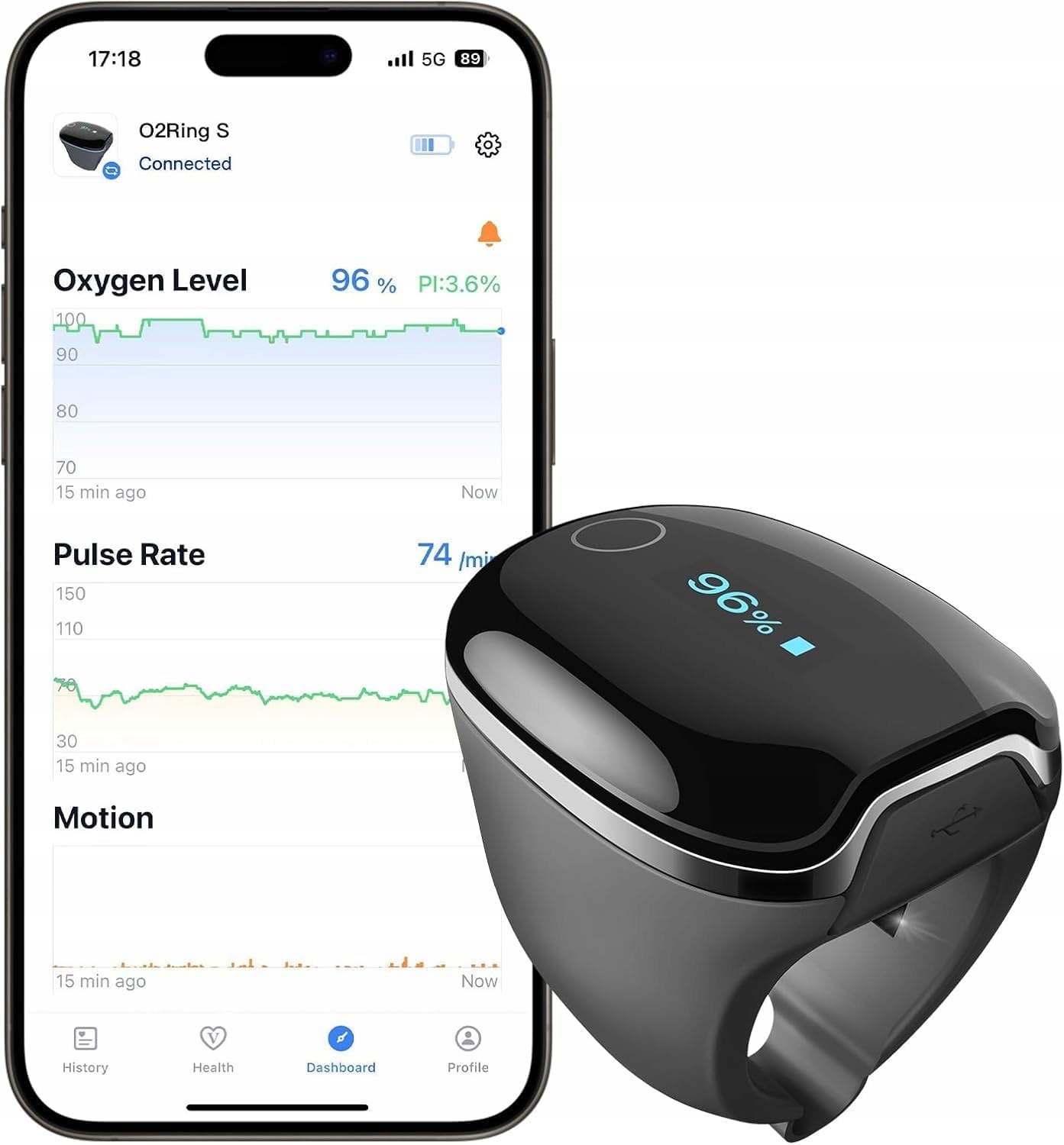 Wellue O2Ring-S – Pulsoksymetr Nocny Monitor Snu z Wibracjami i Bluetooth