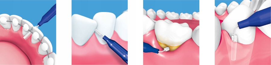 Doskonałe czyszczenie przestrzeni międzyzębowych