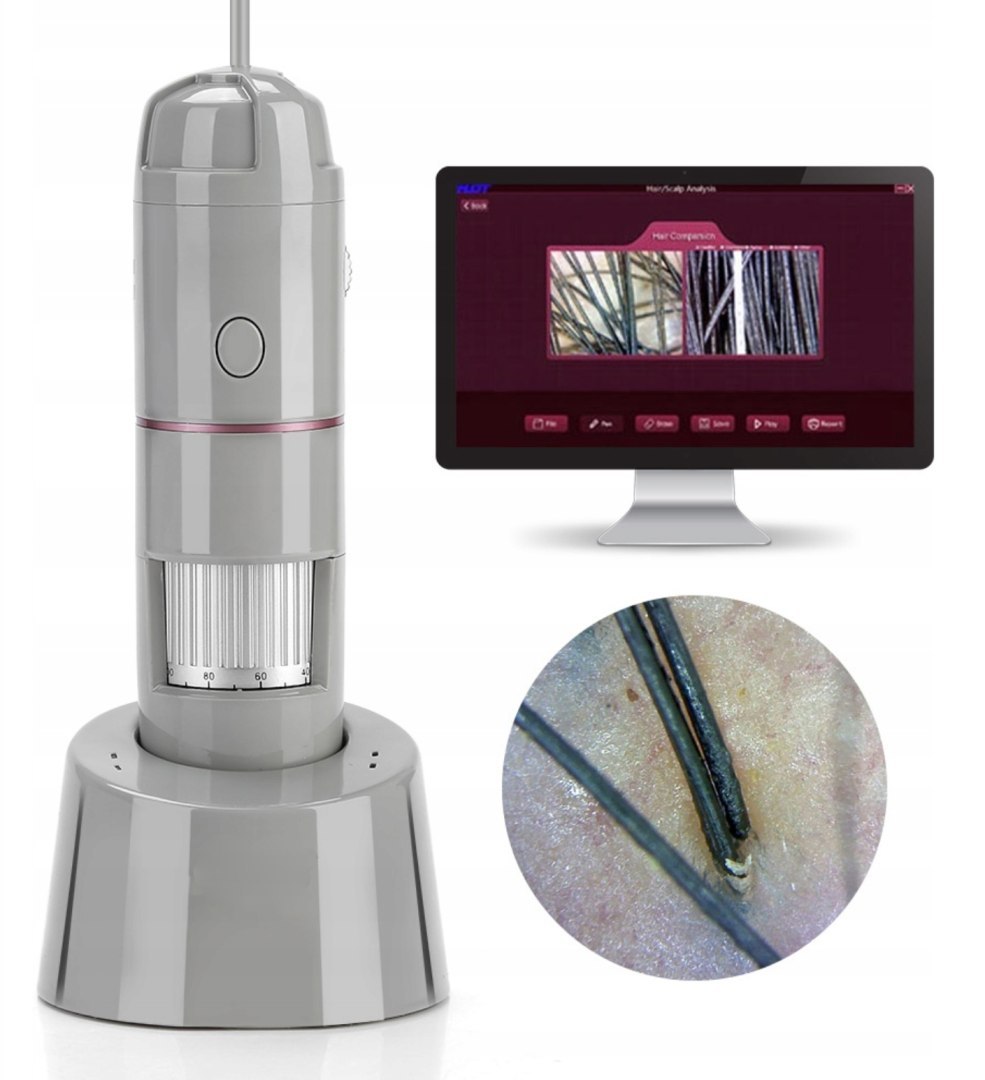 Profesjonalne oprogramowanie HotScalp – Łatwe generowanie raportów