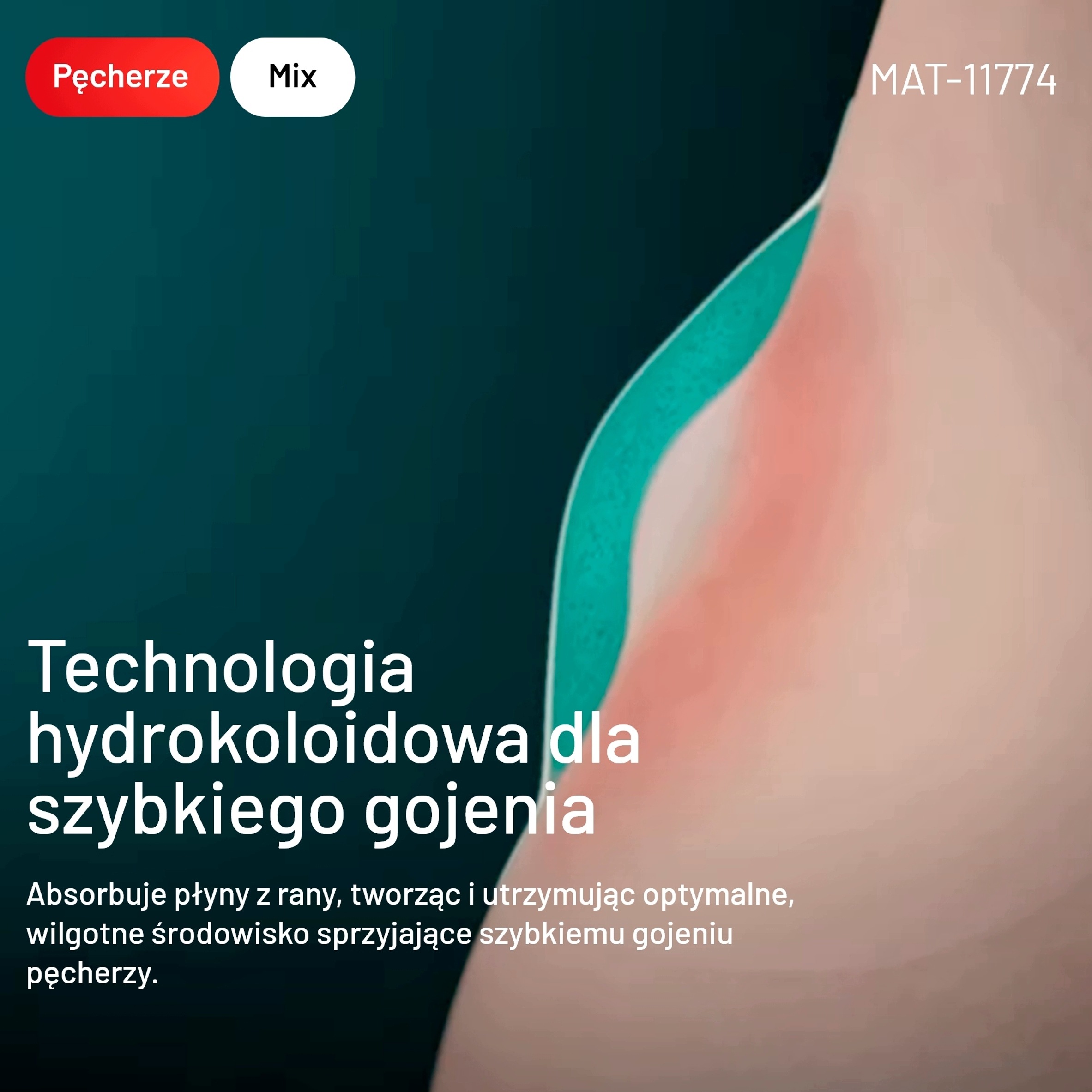 Technologia hydrokoloidowa – Jak działa plaster na pęcherze?