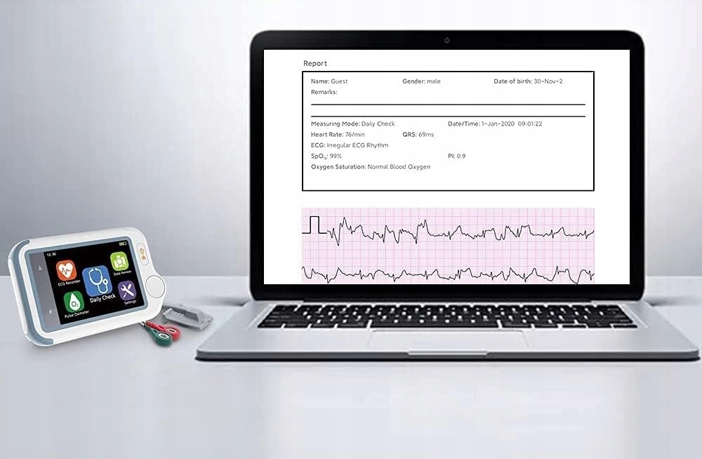 Aplikacje mobilne dla iOS i Android