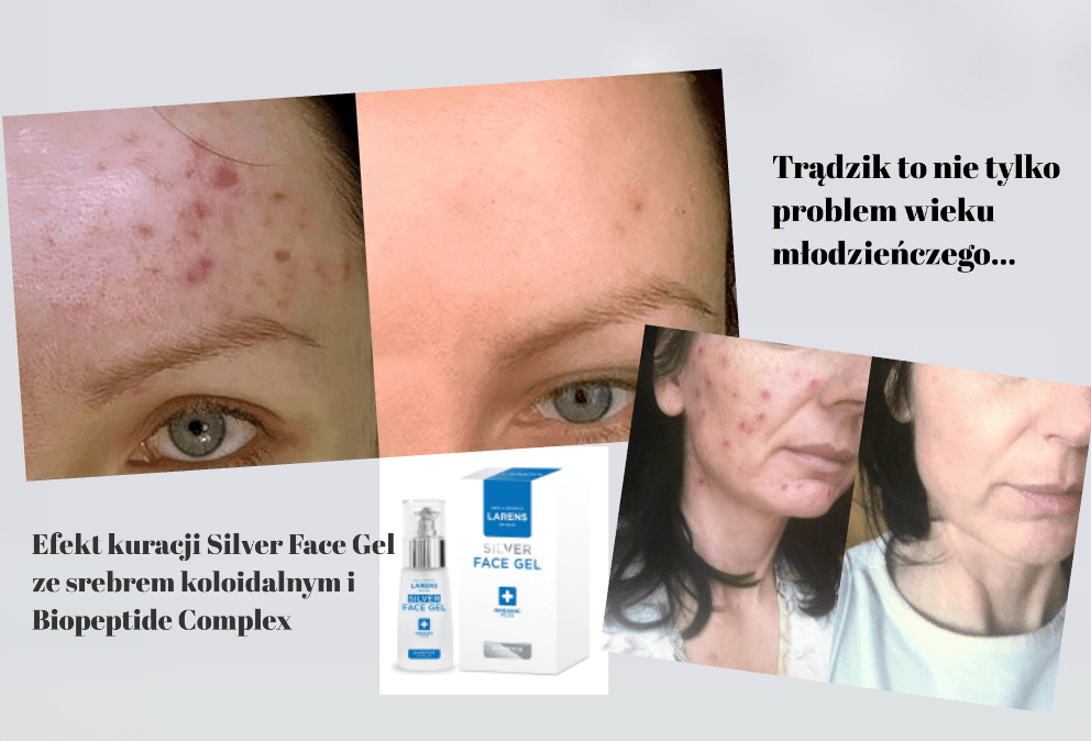Wellu Larens Peptidum Silver Face Gel Efekty Stosowania