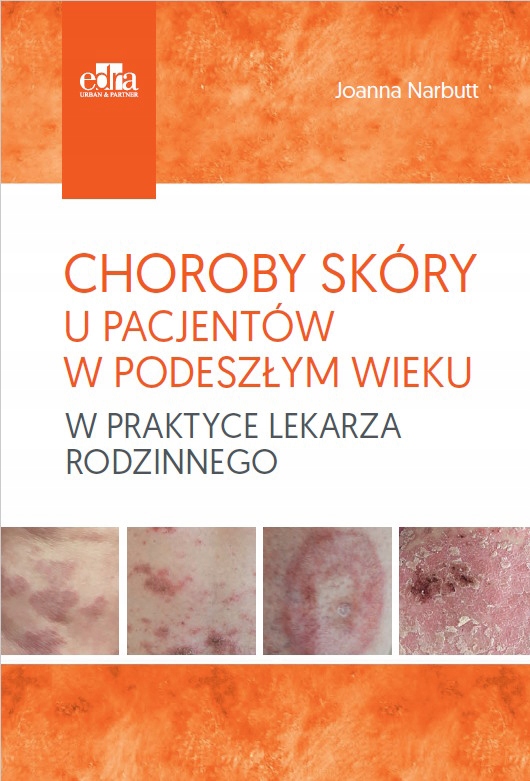 Choroby skóry u pacjentów w podeszłym wieku w praktyce lekarza rodzinnego – Kluczowe informacje