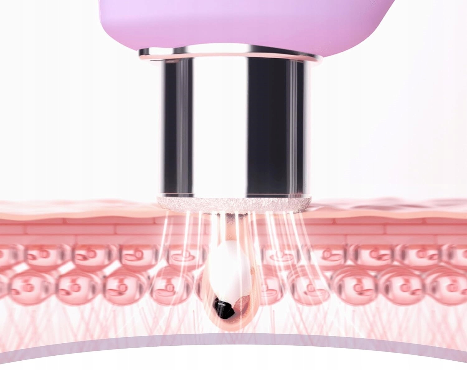 Skuteczne usuwanie zaskórników i niedoskonałości