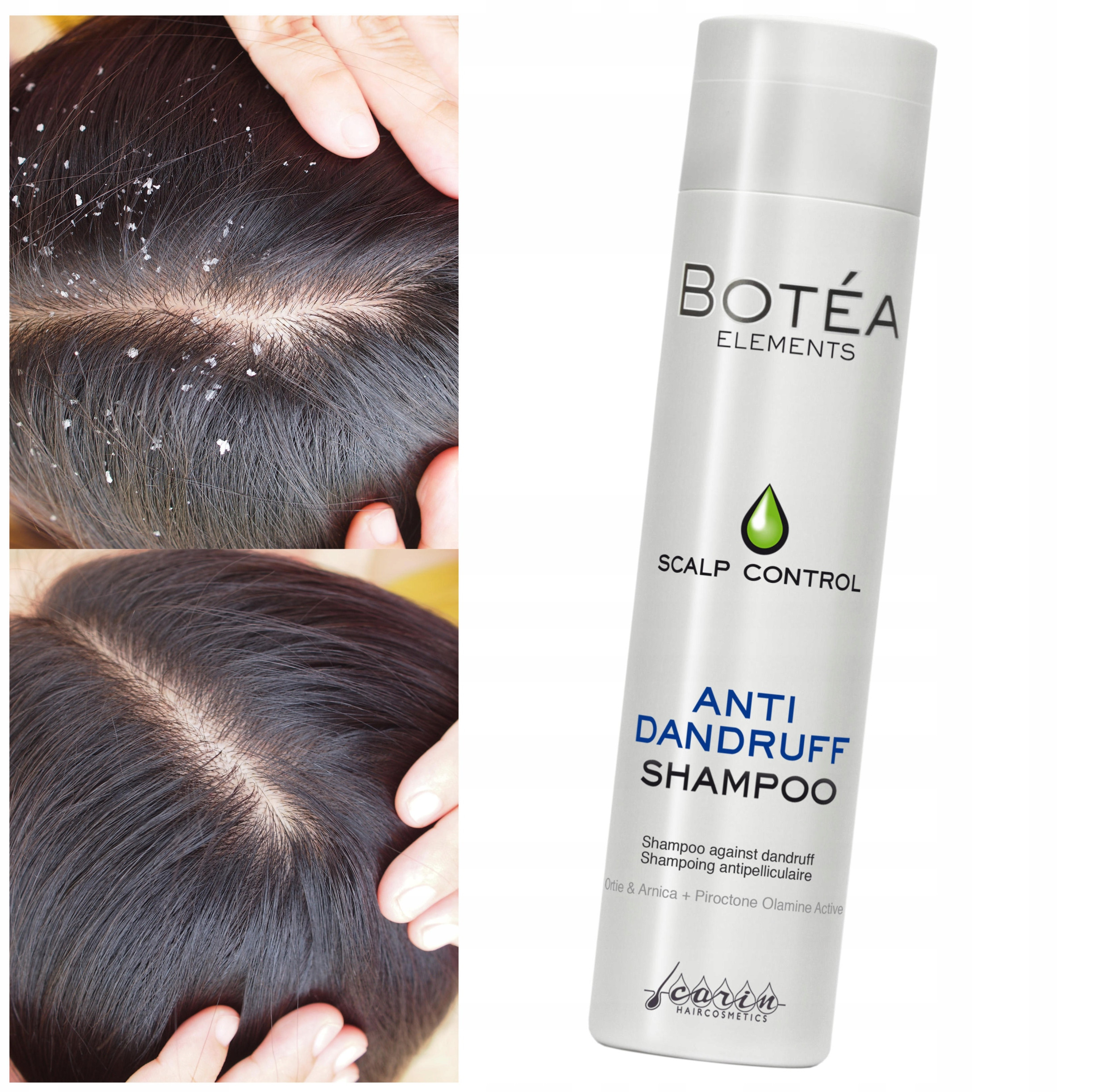 Działanie przeciwłupieżowe i łagodzące