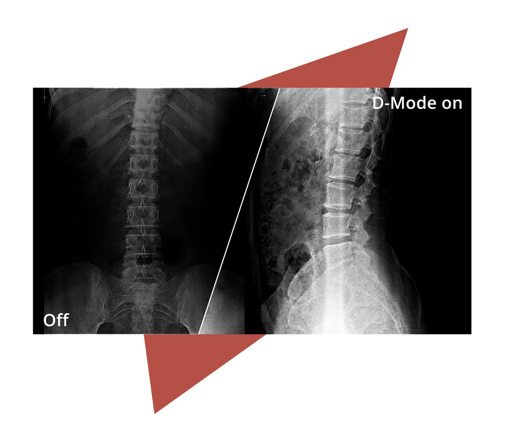 Technologia Anti-Blue Light dla lepszego komfortu