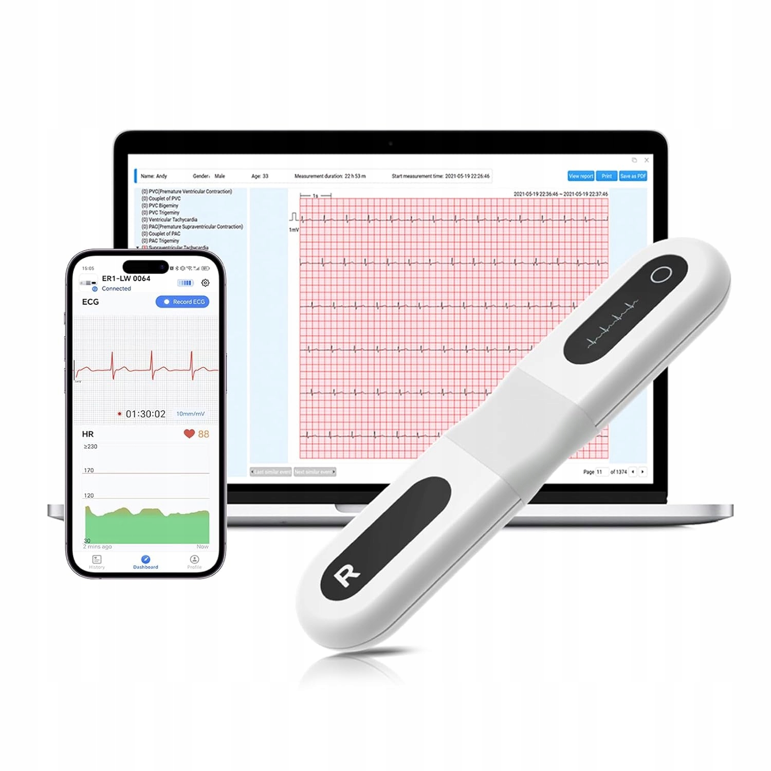 CheckMe ER1-LW – Przenośny 24-godzinny monitor EKG metodą Holtera AI