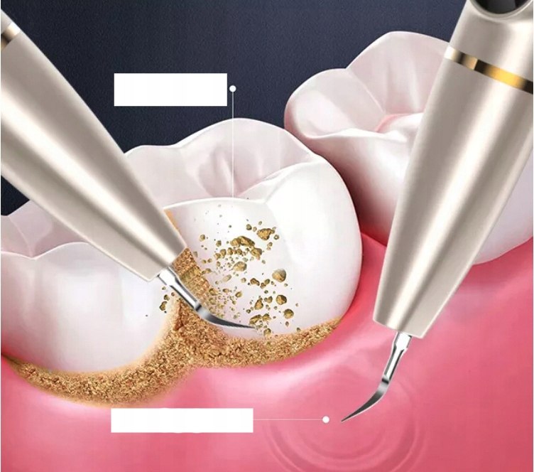 Skaler Dentystyczny Kamera Ultradźwiękowy Braders Funkcje regulacja prędkości