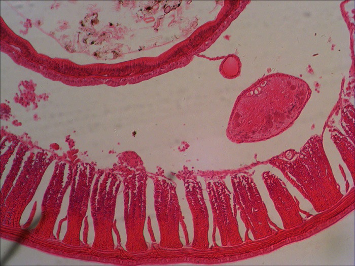 15-earthworm.jpg
