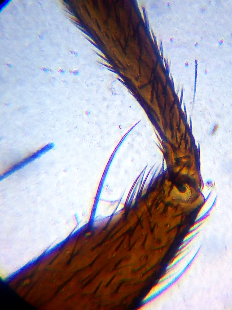 lvh-labzz-101-01.jpg