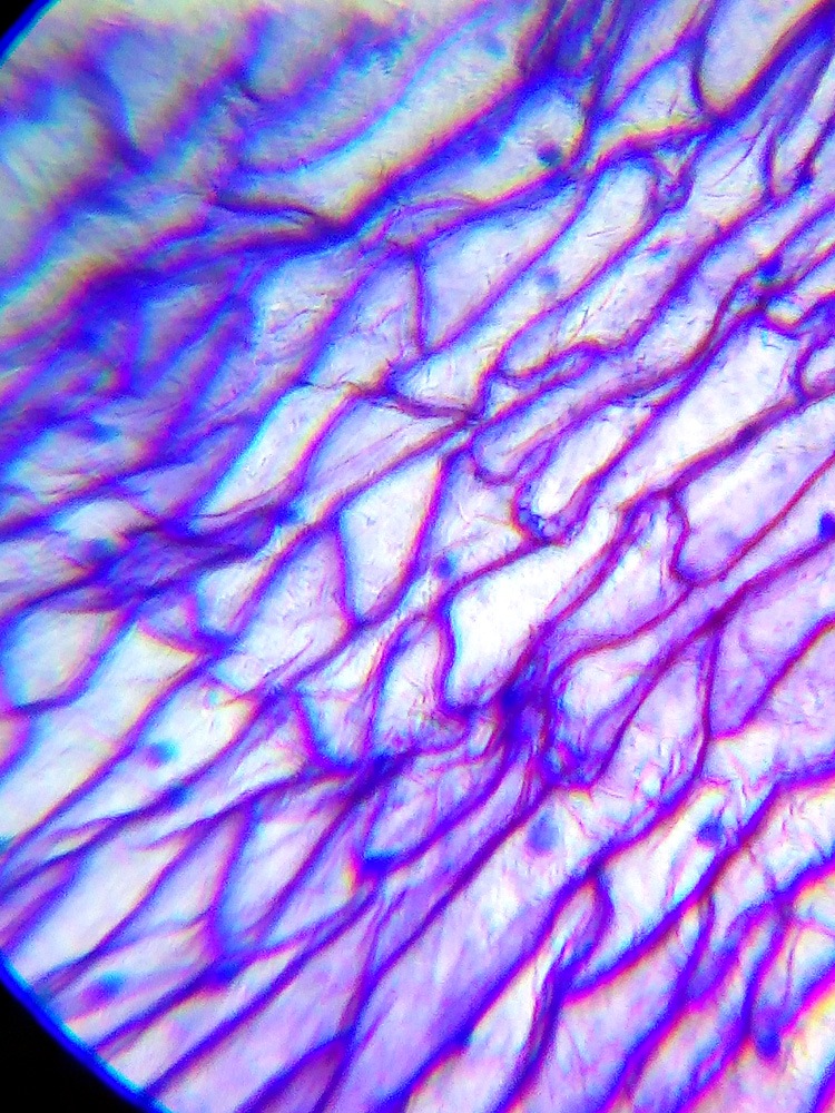 lvh-labzz-101-02.jpg