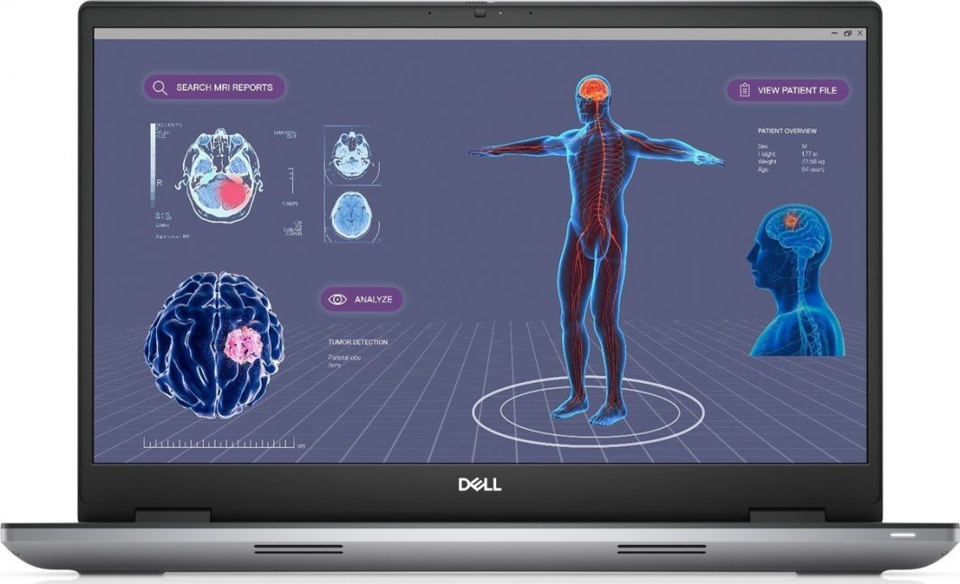 Laptop Dell DELL Precision 7780 i7-13850HX Mobilna stacja robocza 43,9 cm (17.3") Full HD Intel Core i7 32 GB DDR5-SDRAM 512 GB SSD NVIDIA RTX 2000 Wi-Fi 6E (802.11ax) Windows 11 Pro Szary 1