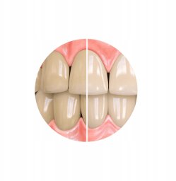 Sensitivity Relief Whitening Toothpaste (PdZ,UNI,100)