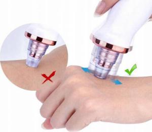 Bezprzewodowe urządzenie do usuwania wągrów 5