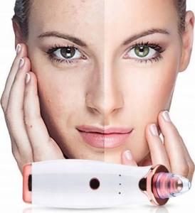 Bezprzewodowe urządzenie do usuwania wągrów 6