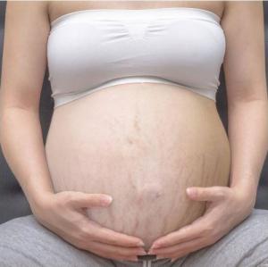 Ardo ARDO Krem przeciw rostępom NATAL ANTI -STETCH NOWOŚĆ! one size 5