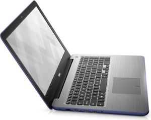 Laptop Dell Inspiron 5567 (5567-9835) 2