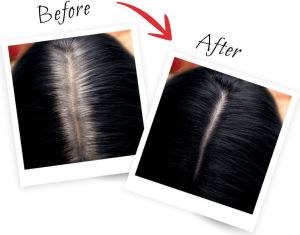 L’Oreal Paris Magic Retouch Spray do retuszu odrostów nr 1 Czerń 75ml 2