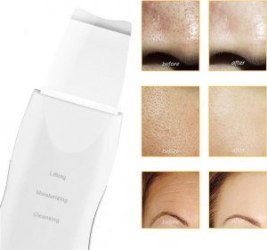 Aptel Bezprzewodowe urządzenie do peelingu kawitacyjnego AG207F 5