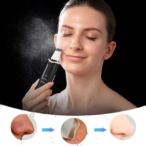 Retoo Peeling kawitacyjny bezprzewodowy 5w1 do twarzy 10