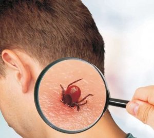 Vera Zestaw przeciw kleszczom w opakowaniu z tkaniny wodoodpornej 3