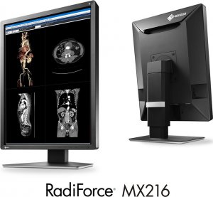 Monitor Eizo RadiForce MX216-HBBK 2