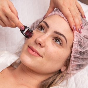 Retoo WAŁEK ROLLER MASAŻER IGŁY DO TWARZY ZAROSTU BRODY -mały 4