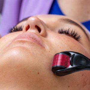 Retoo WAŁEK ROLLER MASAŻER IGŁY DO TWARZY ZAROSTU BRODY -mały 6