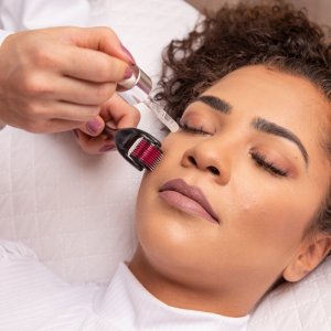 Retoo WAŁEK ROLLER MASAŻER IGŁY DO TWARZY ZAROSTU BRODY -mały 8