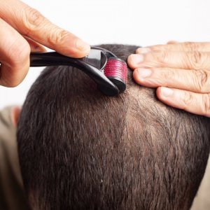 Retoo WAŁEK ROLLER MASAŻER IGŁY DO TWARZY ZAROSTU BRODY -mały 10