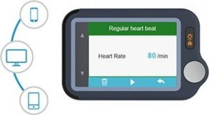 Wellue Monitor EKG Pulsebit z kablem 2