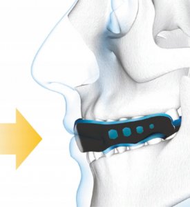 Żelowy Ochraniacz na Zęby Szczęki Gel Max Senior Czarny 2