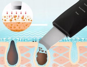 Verk PEELING KAWITACYJNY DO TWARZY ULTRADŹWIĘKOWY AKU 8
