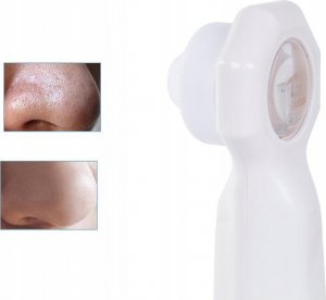 Verk ODKURZACZ DO WĄGRÓW ZASKÓRNIKÓW PRYSZCZY LUPA LED 3