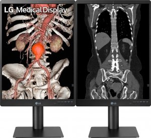 Monitor LG 21HQ513D-B Diagnostic Monitor 11