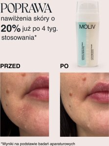 MOLIV Krem do twarzy nawilżający z żywymi probiotykami 30ml 11