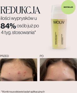 MOLIV Regenerujący krem do twarzy z żywymi probiotykami 30ml 9