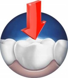 Szczoteczka Oral-B SZCZOTECZKA ELEKTRYCZNA Oral-B PRO 750 CROSS ETUI 11