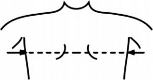 Ascent Meditech Limited Pas żebrowy wsparcie stabilizacja mostka z wkładką 3