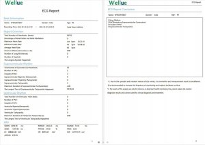 Ciśnieniomierz Wellue 72-godzinny Holter EKG z ekranem Analiza Aplikacja na PC i telefon ER1-LW 4