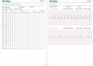 Ciśnieniomierz Wellue 72-godzinny Holter EKG z ekranem Analiza Aplikacja na PC i telefon ER1-LW 5