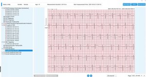 Ciśnieniomierz Wellue 72-godzinny Holter EKG z ekranem Analiza Aplikacja na PC i telefon ER1-LW 7