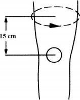 OrthoVisions ORTEZA KOLANA STABILIZATOR z ujęciem rzepki OPASKA 8